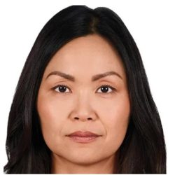 JUVÉDERM® VOLUMA® XC Before & After Patient #1654